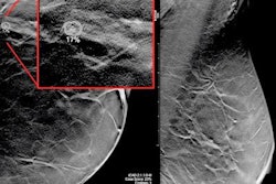 2021 03 11 18 38 4449 2021 03 12 Breast Cancer Dbt Image 20210311180753
