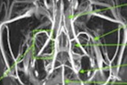 2021 03 12 22 24 3076 2021 03 12 Mri Contrast 20210312224936