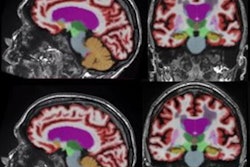 2021 03 15 17 01 7216 2021 03 17 Av Insider 20210315175354