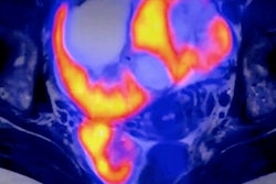 2021 03 15 22 05 3975 Pet Mri 400