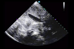 2021 03 16 16 51 4411 2021 03 16 Ai Ultrasound Thumbnail
