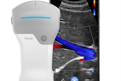 2021 03 16 17 25 0738 2021 03 16 Ge Ultrasound