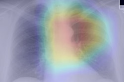 2021 03 22 16 22 8261 2021 03 22 Ai Age 400