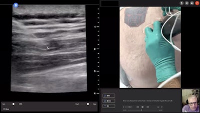 Dr. Peter Weimersheimer supervises an ultrasound-guided nerve block remotely. Image courtesy of Dr. Peter Weimersheimer.