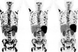 2021 03 22 23 28 3519 2021 03 19 Jnm Chen Neuroencocrine Pet 20210322235331