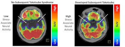 Images courtesy of the European Heart Journal.