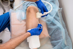 2021 03 26 18 21 5122 Interventional Ultrasound Rf Ablation 400