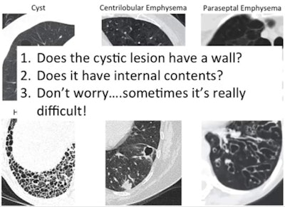 Three top tips for determining pathology in air-filled cystic lesion. Courtesy of Prof. Peter Beddy.