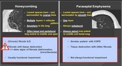 CT signs of honeycombing versus paraseptal emphysema. Courtesy of Prof. Johny Verschakelen.