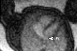 2021 03 26 21 01 9641 2021 03 29 Jama Network Fetal Mri 20210326220436