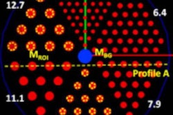 2021 03 26 23 33 8801 2021 03 29 New Spect Image 20210326233135