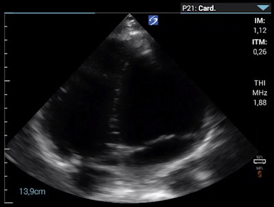 Apical four-chamber view on the morning of day eight.