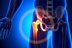 2021 02 18 23 34 2180 Hip Joint 400