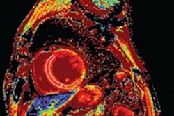 2021 04 01 21 00 0421 2021 04 02 Cardiac Mri Fig 3 20210401210319