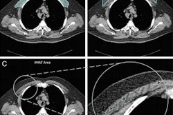 2021 04 05 19 45 9714 2021 04 06 Ct Copd Figure3 20210405195835