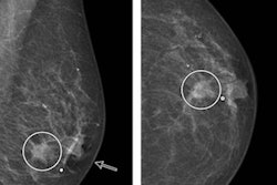 2021 04 05 20 26 1049 2021 04 06 Radiology Dbt Version2 20210405205203