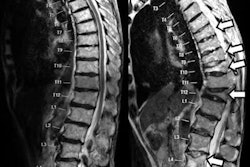 2021 04 05 23 08 3863 2021 04 06 Bone Fractures 20210405231611