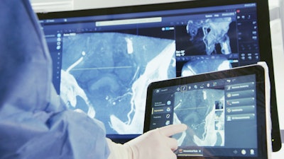 SmartCT includes a table-side touchscreen control that offers interventionalists enhanced diagnostic confidence and streamlined workflows. Image courtesy of Philips Healthcare.