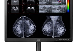 2021 04 07 18 33 2384 2021 04 07 Lg Monitor