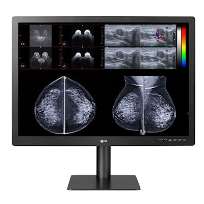 LG's 12-megapixel multimodality monitor. Image courtesy of LG.