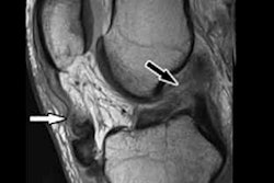 2021 04 07 21 02 1887 2021 04 08 5 Minute Mri Figure3 400