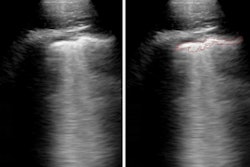 2021 04 08 19 41 3220 2021 04 09 Sultan Lung Ultrasound 400