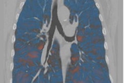 2021 04 08 20 08 7445 2021 04 09 Ai Copd 20210408205021