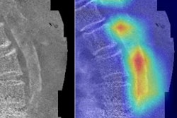 2021 04 10 00 55 8122 2021 04 12 Aortic Calcification1 20210410003437