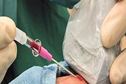 2021 04 13 20 42 3667 2021 04 14 Ultrasound Guidance Redo 20210413205433