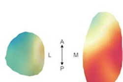 2021 04 14 20 34 6737 2021 04 15 3 D Knee Ct 20210414202019