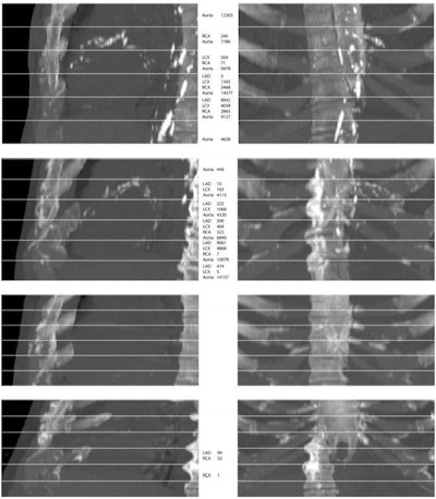 Maximum intensity projections (MIPs) of four randomly selected images from the evaluation set