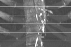 2021 04 14 21 10 1182 2021 04 15 Ldct Heart Disease Figure4 400