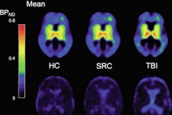 2021 04 19 20 46 4935 2021 04 19 Pet Tracer Imaging 20210419205544