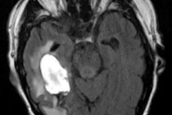 2021 04 20 21 36 2833 2021 04 21 Brain Mr Is Figure1 20210420215610
