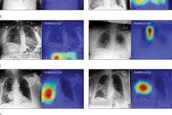 2021 04 22 22 25 2250 2021 04 23 Ards Images 20210422222935