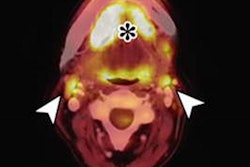 2021 04 26 18 12 7083 2021 04 27 Fused Pet Ct Image B 20210426185844