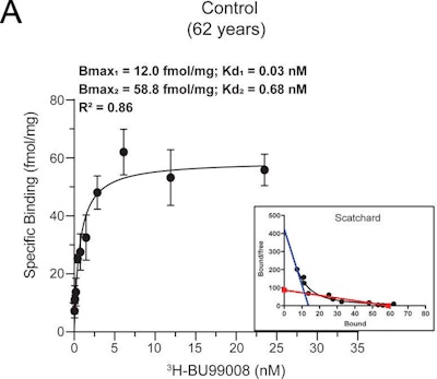 3H-BU99008 saturation binding studies were performed in temporal cortex brain tissue homogenates from one control and one patient with Alzheimer's disease (AD) using increasing concentrations of 3H-BU99008 (0-35 nM). A and B show the saturation binding curves for the control subject (62 years old) and the one with Alzheimer's disease (85 years old), along with the corresponding Scatchard plots. For the control, the second binding site was drawn manually after fitting the data using the Hill slope-specific binding function in GraphPad Prism 8.3 software (A; blue dotted line). Data are presented as means ± standard error of mean (SEM) of two experiments in triplicate. Kd = dissociation constant. Images courtesy of Molecular Psychiatry.
