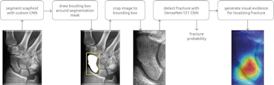 Overview of the scaphoid fracture detection pipeline, which consisted of a segmentation and detection convolutional neural network (CNN). A class activation map is calculated and visualized as a heatmap for fracture localization. Image courtesy of the RSNA.