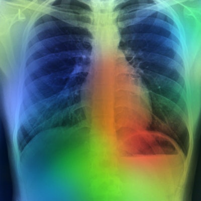 2020 08 21 19 58 9989 Artificial Intelligence Lung Color 400