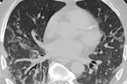 2021 04 30 00 28 9304 2021 04 30 Ai Covid 1 20210430000517