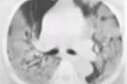 2021 05 05 20 17 6968 2021 05 05 Amvc Giger Ai Midrc Image Severe 400