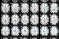 2021 05 07 22 07 9686 2021 05 10 Fdg Brain Clusters 20210507225823