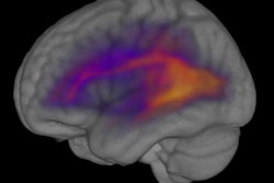 2021 05 11 17 56 2095 2021 05 12 White Matter Density 400
