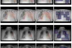 2021 05 12 15 41 7107 2021 05 12 X Ray Covid Image 20210512153423