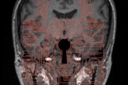 2021 05 15 18 07 3098 2021 05 17 Ismrm Brain Tech Image Square