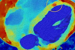 2021 05 19 00 06 1483 2021 05 19 Philips Spectral Ct 20210519000940