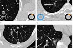 2021 05 19 18 04 1493 2021 05 18 Ai Ct 20210519183025