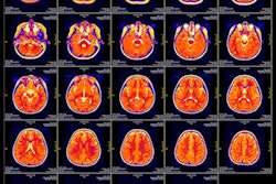 2021 05 20 15 06 5757 Mri Slide 400