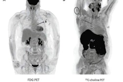 2021 05 21 22 03 9931 2021 05 24 Radiotracer Uptake After Vaccination 400