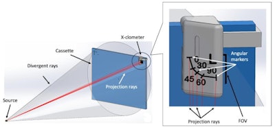 The X-clometer. FOV = field of view. Image courtesy of Dr. Raisa Freidlin.
